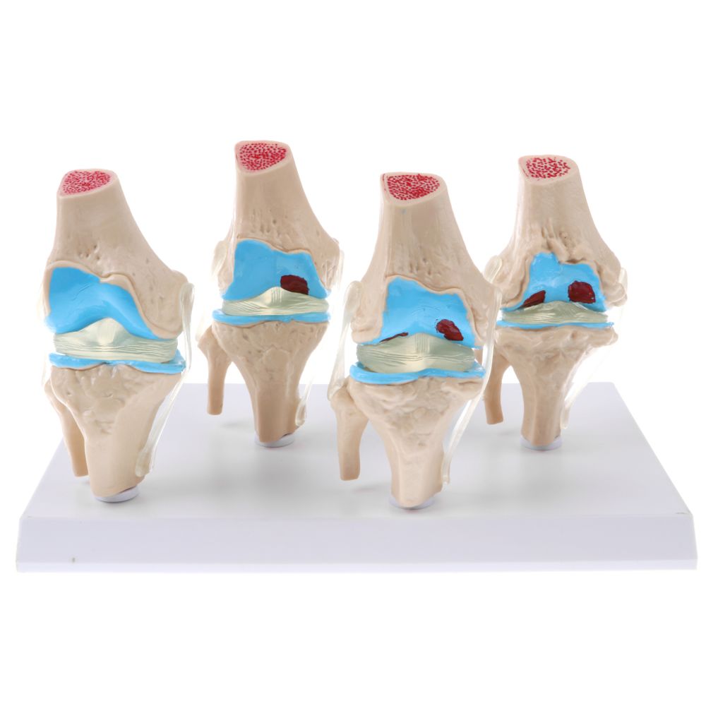 marque generique - Statue de blessure à articulation du genou humain - Jeux éducatifs