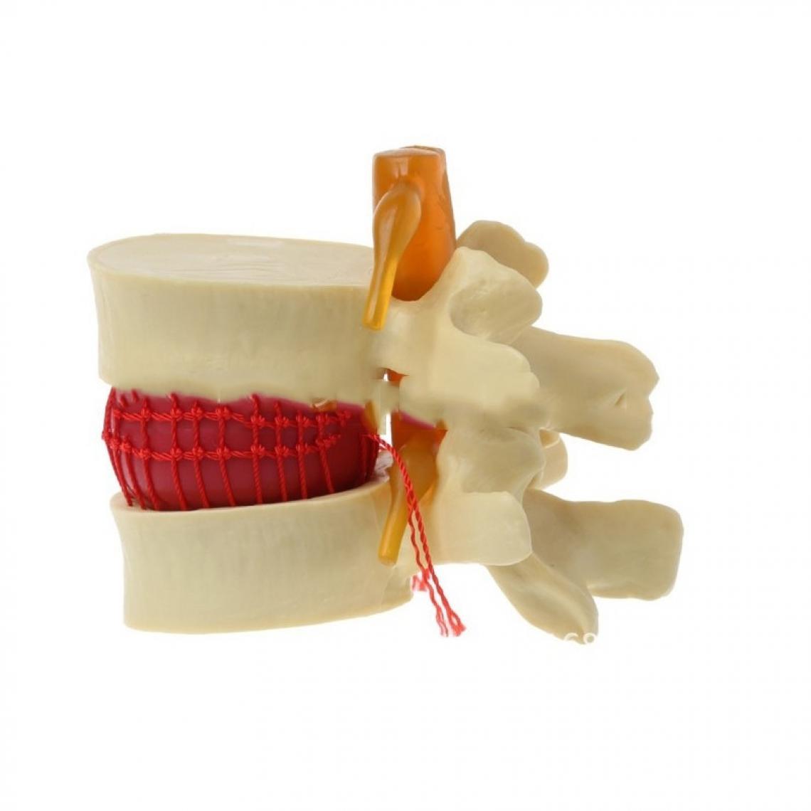 Wewoo - Modèle de démonstration de hernie discale lombaire humaine de colonne vertébrale orthopédique jaune - Jeux éducatifs