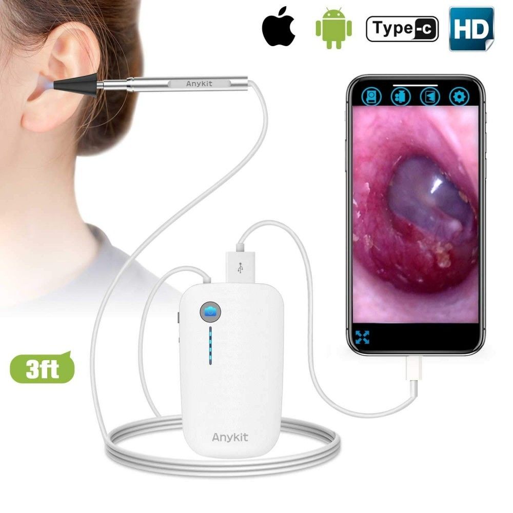 Anykit - Otoscope sans fil Anykit, surveillez la santé de vos oreilles à la maison - Autre appareil de mesure